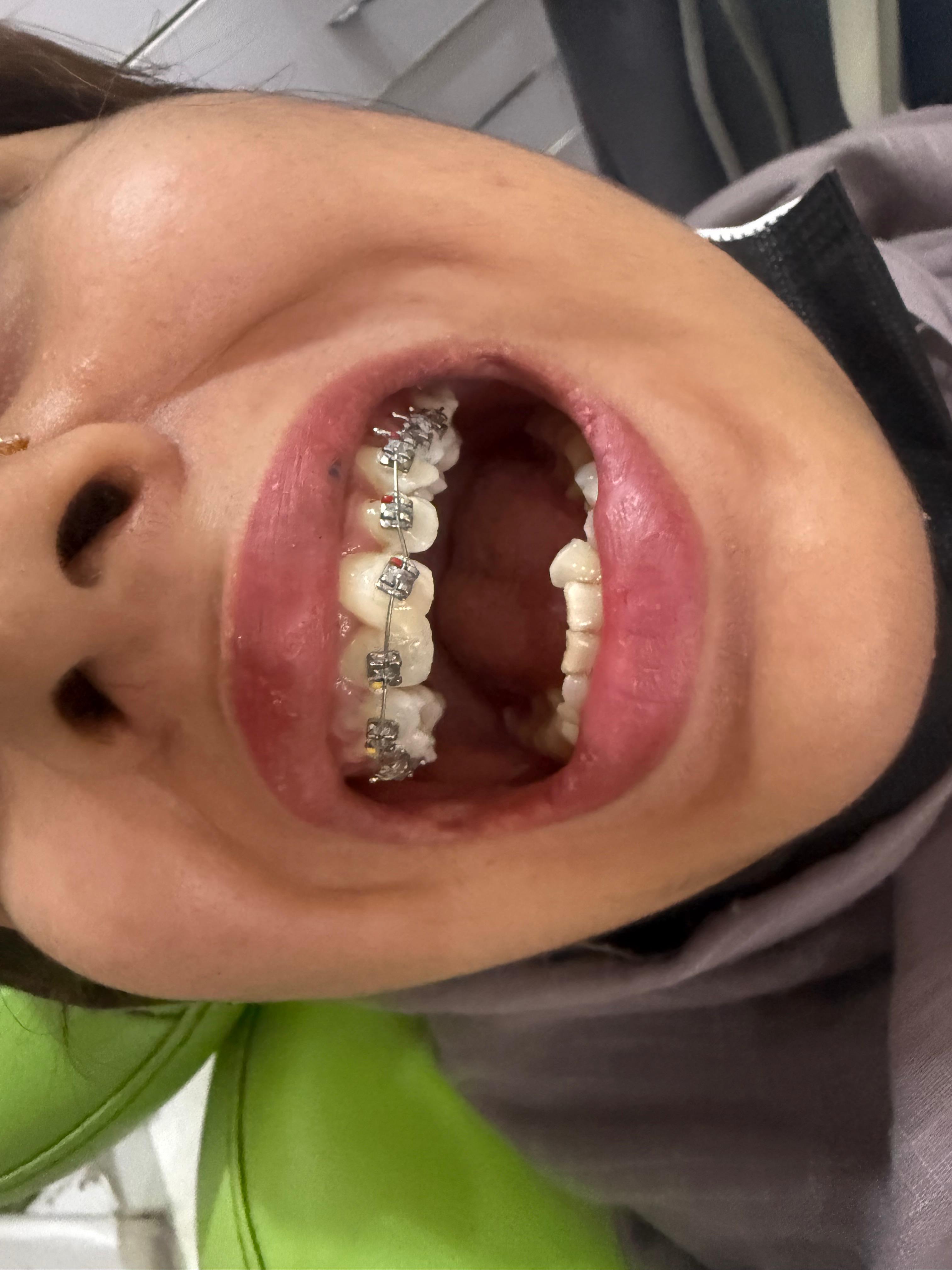 Orthodontics