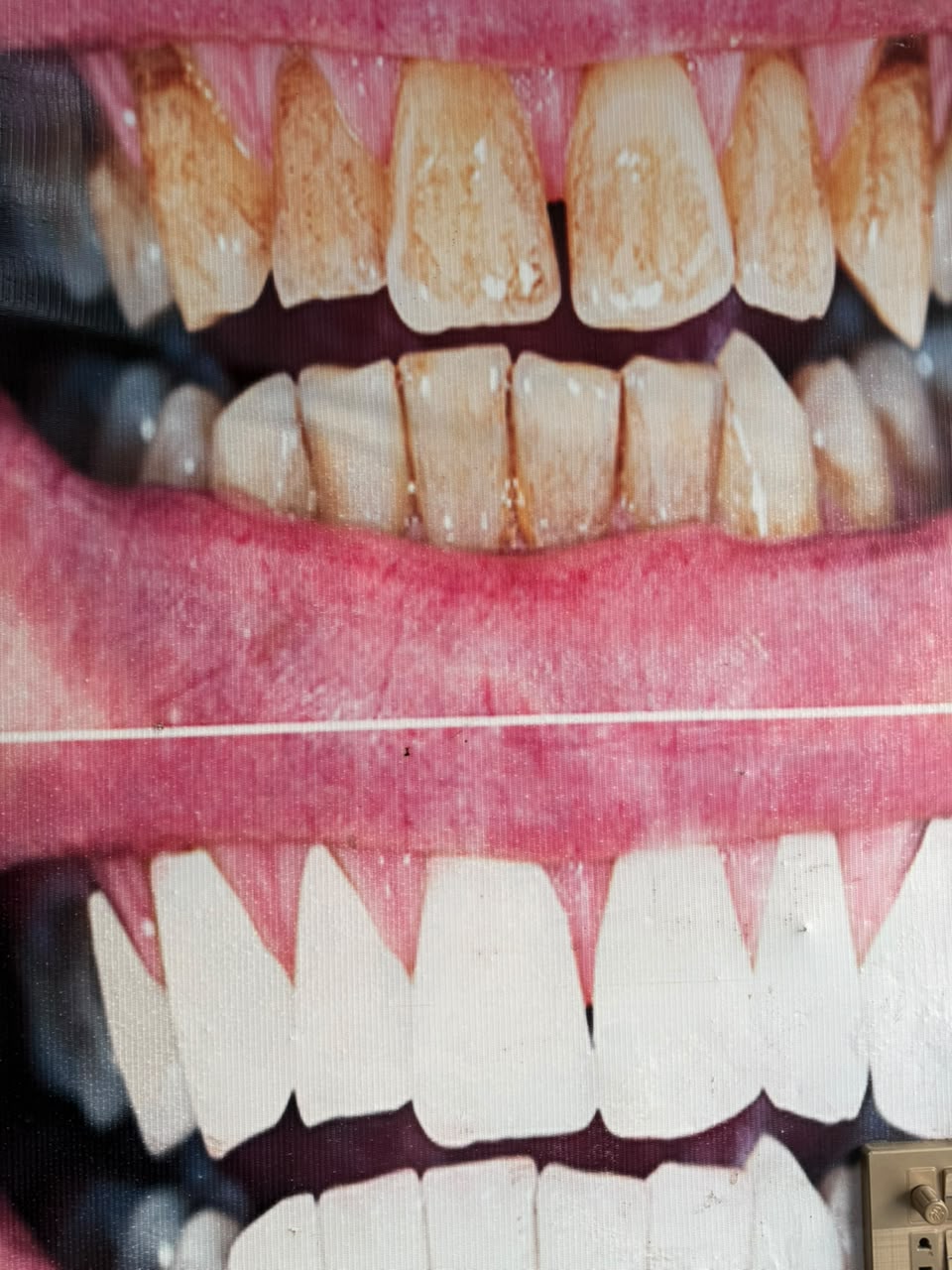 Dental treatment