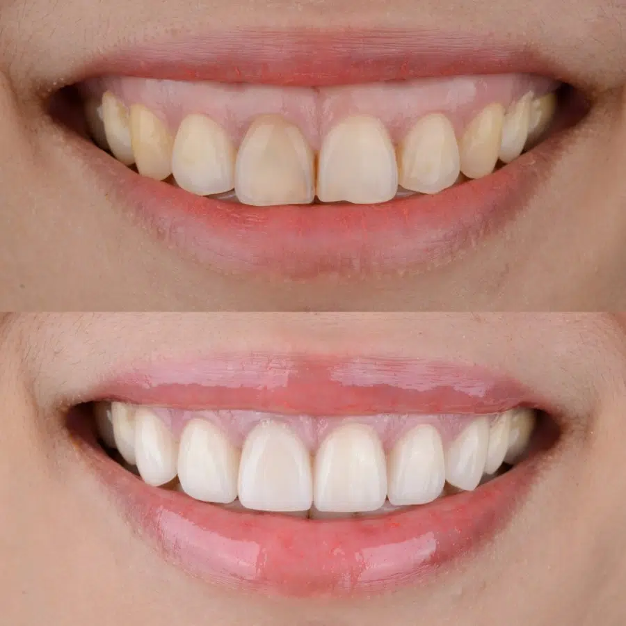 Dental treatment at Gulfam Dental Clinic