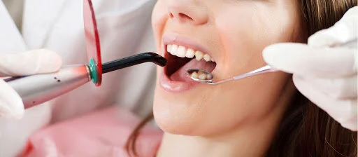Dental treatment at Gulfam Dental Clinic